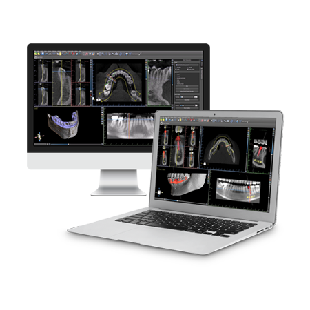 Guided Surgery